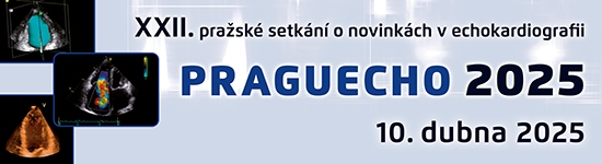 PRAGUECHO 2025